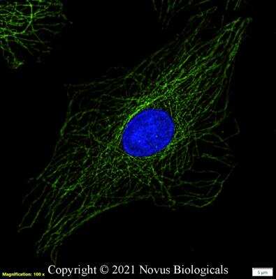 Immunocytochemistry/ Immunofluorescence: alpha Tubulin Antibody (YL1/2) - BSA Free [NB600-506]