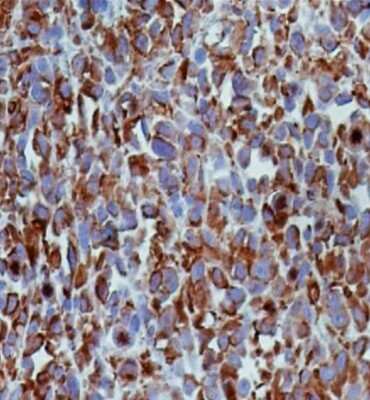 Immunohistochemistry-Paraffin: alpha Tubulin Antibody (YL1/2) - BSA Free [NB600-506]