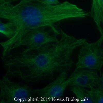 Immunocytochemistry/ Immunofluorescence: alpha Tubulin Antibody (YOL1/34) - BSA Free [NB100-1639]