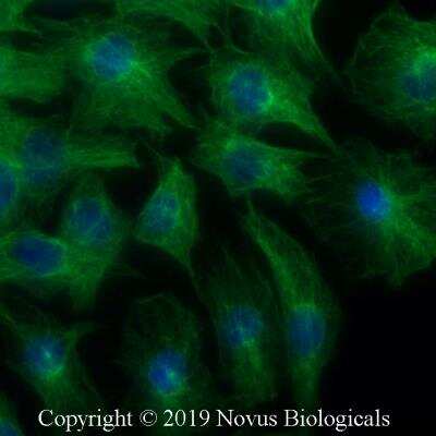 Immunocytochemistry/ Immunofluorescence: alpha Tubulin Antibody (YOL1/34) - BSA Free [NB100-1639]
