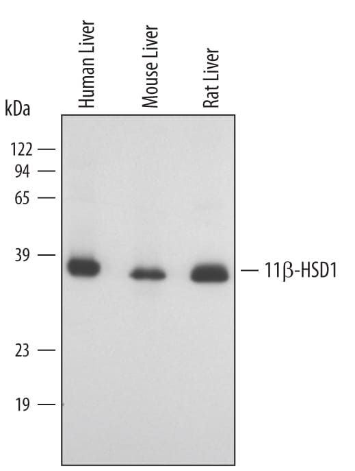 Detection of Human/Mouse/Rat 11 beta -HSD1 antibody by Western Blot.