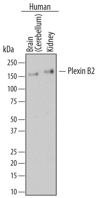 Detection of Human Plexin B2 antibody by Western Blot.