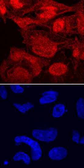 TAZ/WWTR1 antibody in BG01V Human Embryonic Stem Cells by Immunocytochemistry (ICC).