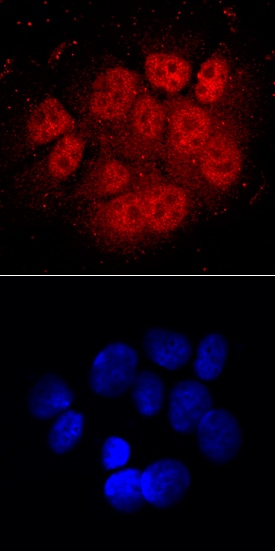ARNT/HIF-1 beta  antibody in MCF-7 Human Cell Line by Immunocytochemistry (ICC).