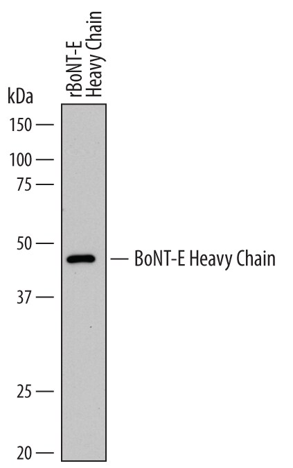 Detection ofC. botulinumBoNT-E Heavy Chain antibody by Western Blot.