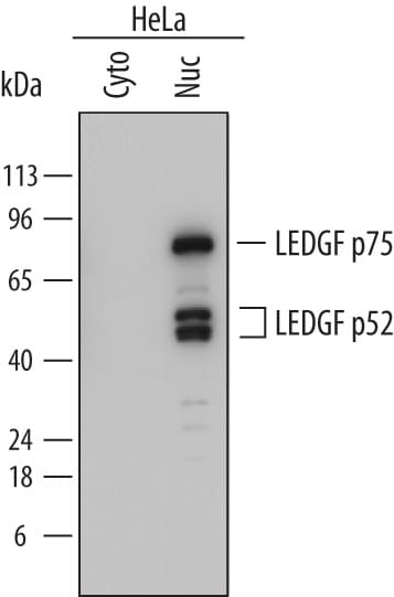 Detection of Human LEDGF antibody by Western Blot.
