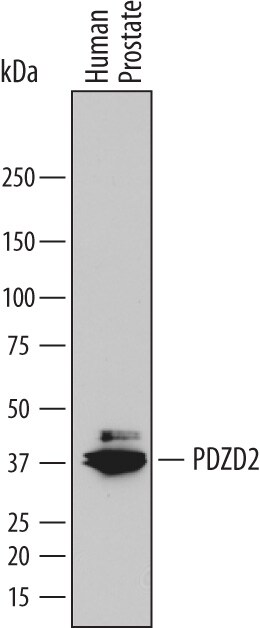 Detection of Human PDZD2 antibody by Western Blot.