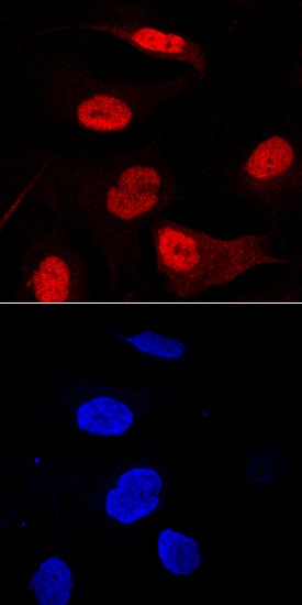 beta -TrCP1/BTRC antibody in A172 Human Cell Line by Immunocytochemistry (ICC).