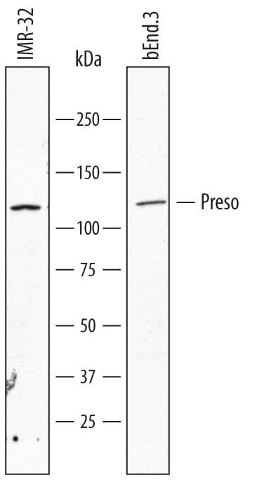 Detection of Human and Mouse Preso/FRMPD4 antibody by Western Blot.