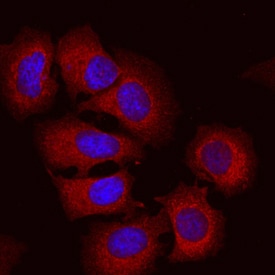 Semaphorin 3C antibody in MCF-7 Human Cell Line by Immunocytochemistry (ICC).