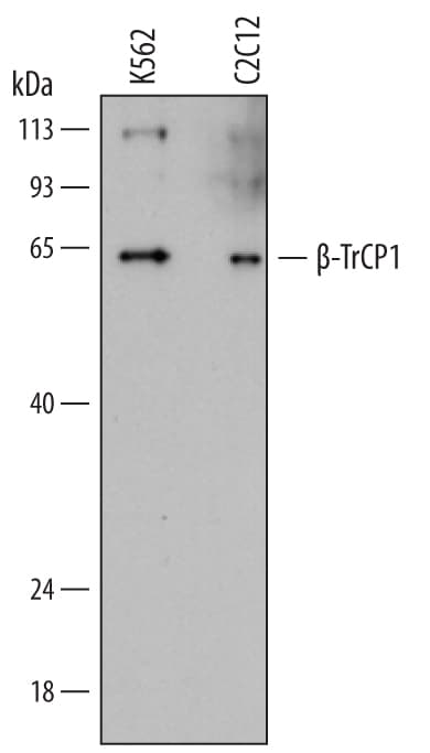 Detection of Human and Mouse  beta -TrCP1/BTRC antibody by Western Blot.