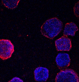 Hemoglobin ? antibody in K562 Human Cell Line by Immunocytochemistry (ICC).