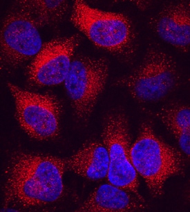 LMP2/PSMB9 antibody in HeLa Human Cell Line by Immunocytochemistry (ICC).