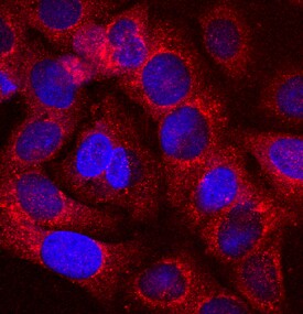 a1-Microglobulin antibody in HepG2 Human Cell Line by Immunocytochemistry (ICC).