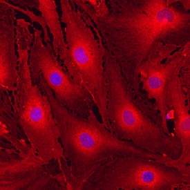 MCAM/CD146 antibody in bEnd by Immunocytochemistry (ICC).3 Mouse Cell Line by Immunocytochemistry (ICC).