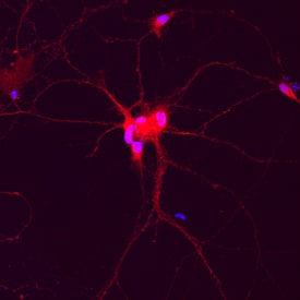 Complexin-1/2 antibody in Rat Hippocampal Neurons by Immunocytochemistry (ICC).