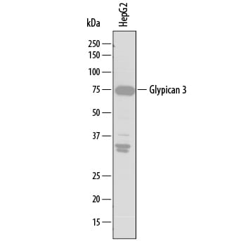 Detection of Human Glypican 3 antibody by Western Blot.