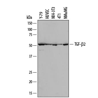 Detection of Human and Mouse TGF-beta 2 antibody by Western Blot.