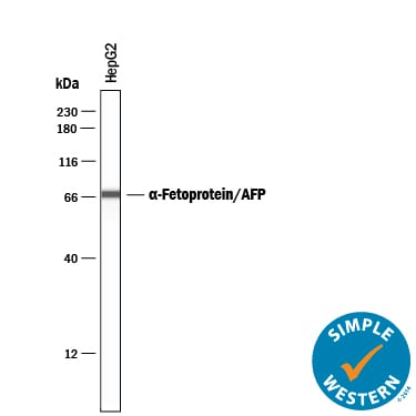 Detection of Human a-Fetoprotein/AFP antibody by Simple WesternTM.