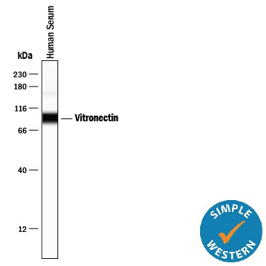 Detection of Human Vitronectin antibody by Simple WesternTM.