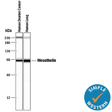 Detection of Human Mesothelin antibody by Simple WesternTM.