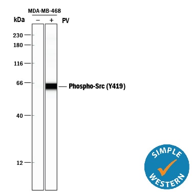 Detection of Human Phospho-Src (Y419) antibody by Simple WesternTM.
