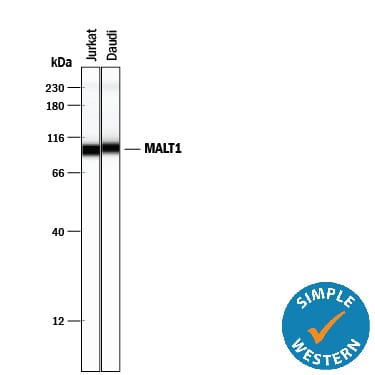Detection of Human MALT1 antibody by Simple WesternTM.