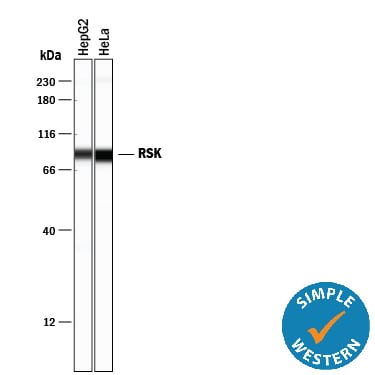Detection of Human RSK antibody by Simple WesternTM.