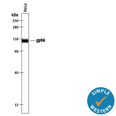 Detection of Human gp96/HSP90B1 antibody by Simple WesternTM.