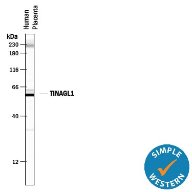 Detection of Human TINAGL1 antibody by Simple WesternTM.