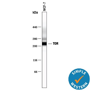 Detection of Human TOR antibody by Simple WesternTM.