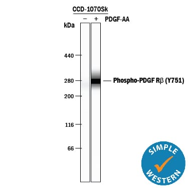 Detection of Human Phospho-PDGF R beta  (Y751) antibody by Simple WesternTM.