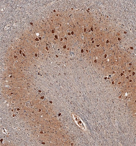 17 beta -HSD14/HSD17B14 antibody in Human Brain by Immunohistochemistry (IHC-P).