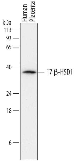 Detection of Human 17  beta -HSD1/HSD17B1 antibody by Western Blot.