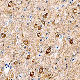 17  beta -HSD1/HSD17B1 antibody in Human Alzheimer's Brain by Immunohistochemistry (IHC-P).