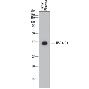 Detection of Human 17  beta -HSD1/ HSD17B1 antibody by Western Blot.