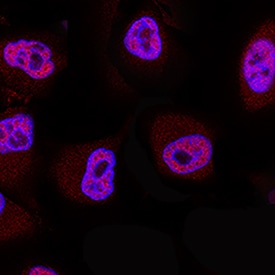 20S Proteasome antibody in A549 Human Cell Line by Immunocytochemistry (ICC).