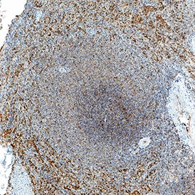 2B4/CD244/SLAMF4 antibody in Human Spleen by Immunohistochemistry (IHC-P).