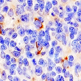 4-1BB/TNFRSF9/CD137 antibody in Human Tonsil by Immunohistochemistry (IHC-P).