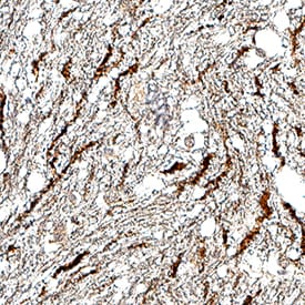 5-HT1D antibody in Human Brain by Immunohistochemistry (IHC-P).