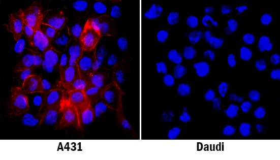 5'-Nucleotidase/CD73 antibody in A431 Human Cell Line by Immunocytochemistry (ICC).