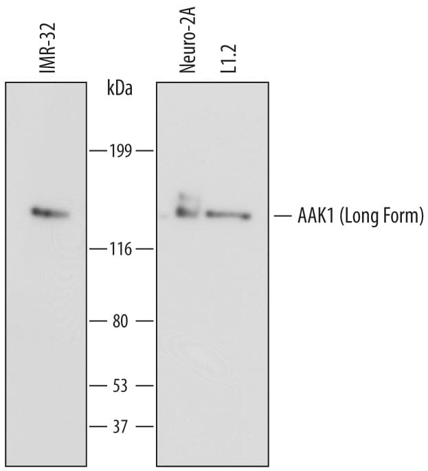 Detection of Human and Mouse AAK1 antibody by Western Blot.