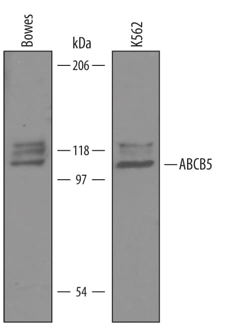 Detection of Human ABCB5 antibody by Western Blot.