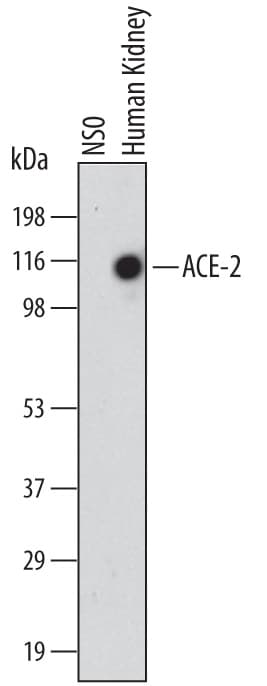 Detection of Human ACE-2 antibody by Western Blot.