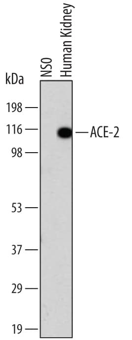 Detection of Human ACE-2 antibody by Western Blot.