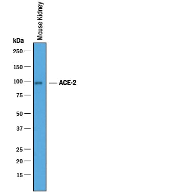 Detection of Mouse ACE-2 antibody by Western Blot.