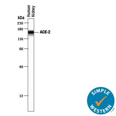 Detection of Human ACE-2 antibody by Simple WesternTM.