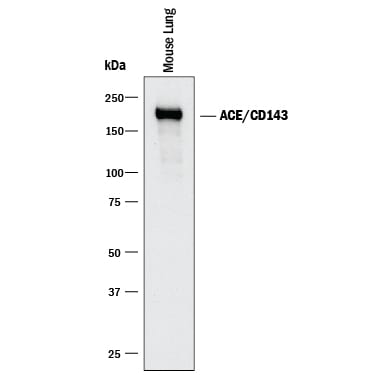 Detection of Mouse ACE/CD143 antibody by Western Blot.