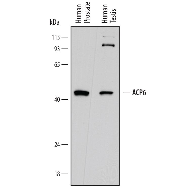 Detection of Human ACP6 antibody by Western Blot.