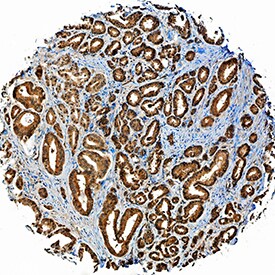ADAM15 antibody in Human Prostate by Immunohistochemistry (IHC-P).